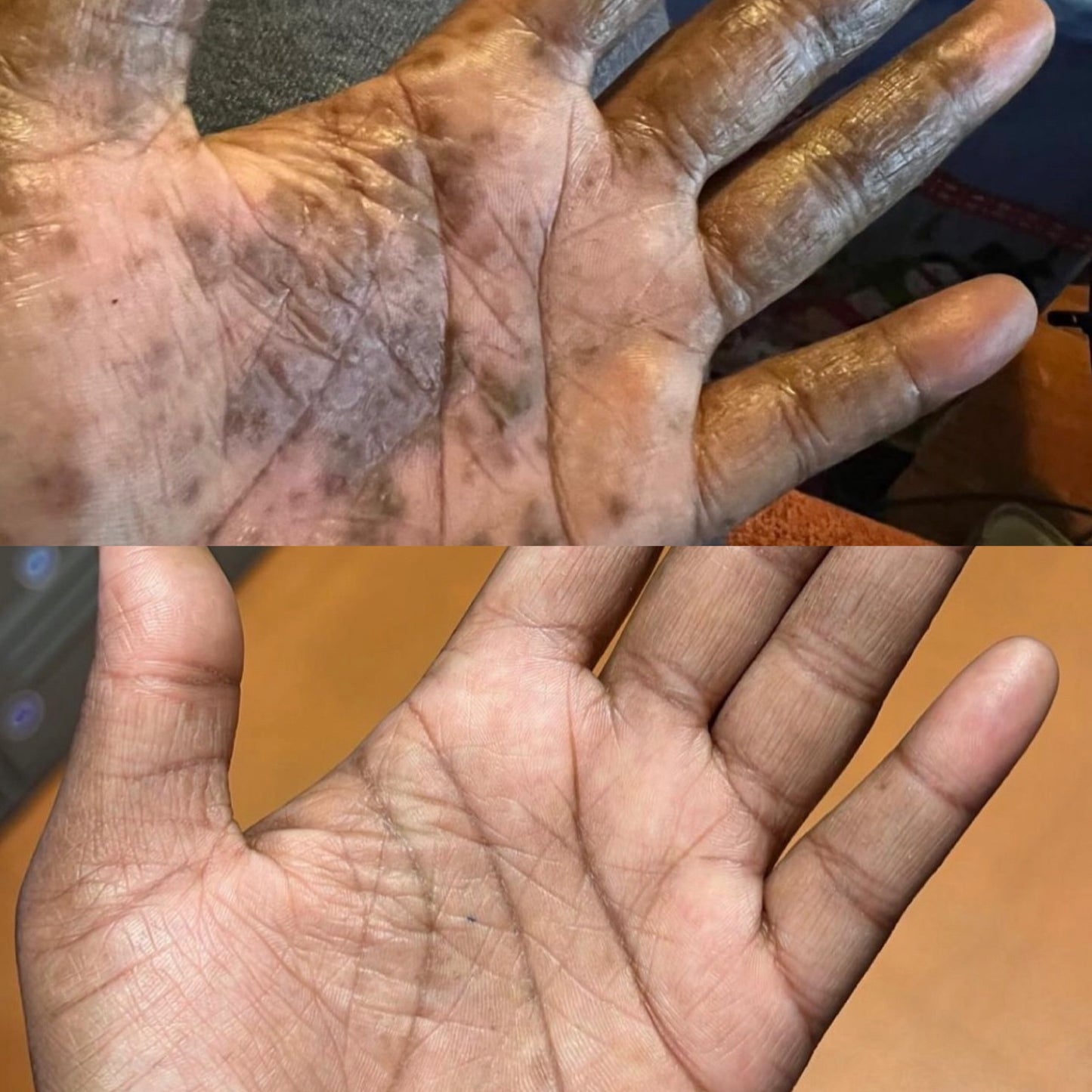 REPAIR skin butter
