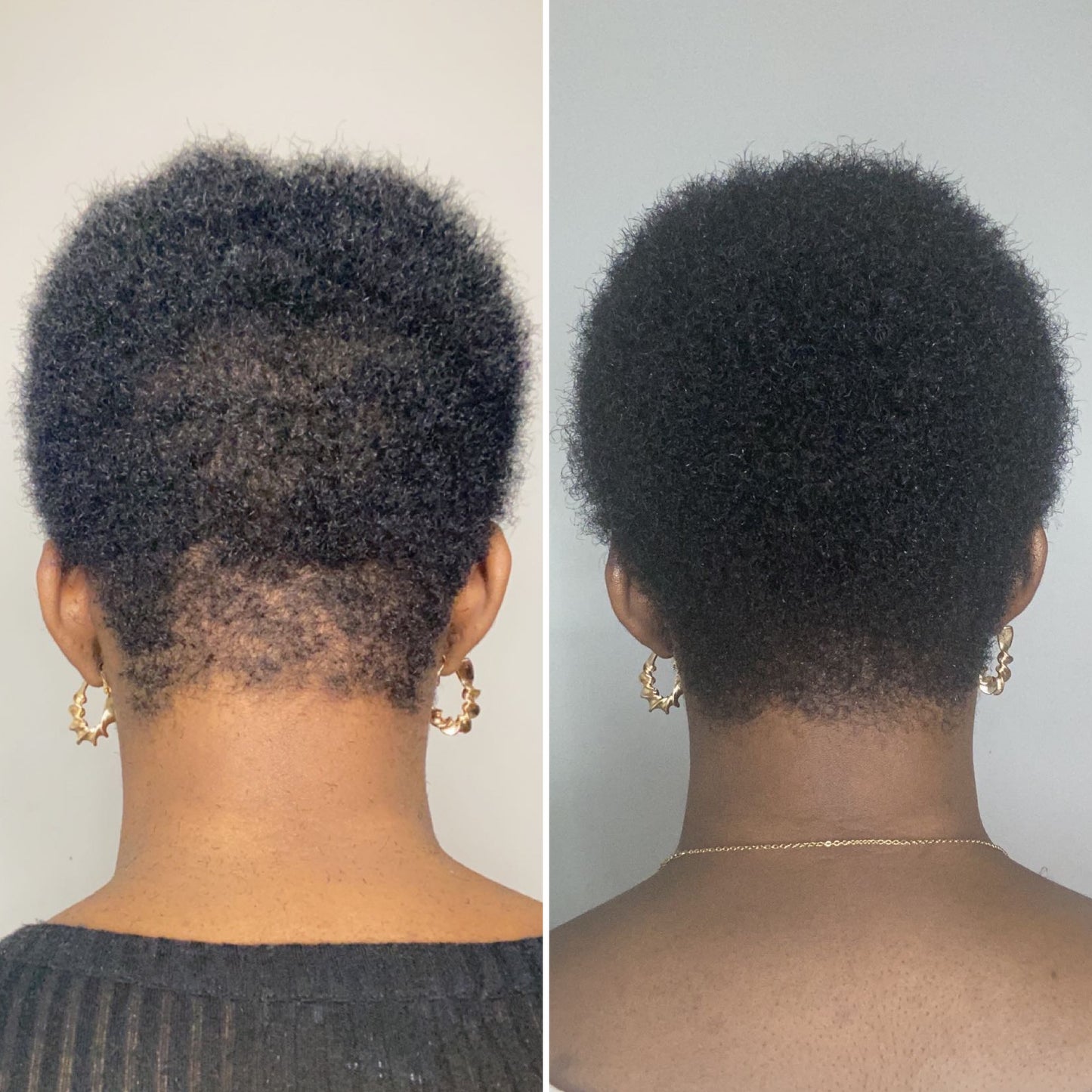 RETAIN hair growth oil