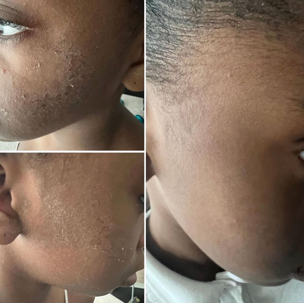 REPAIR skin butter