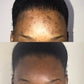 FADE lotion