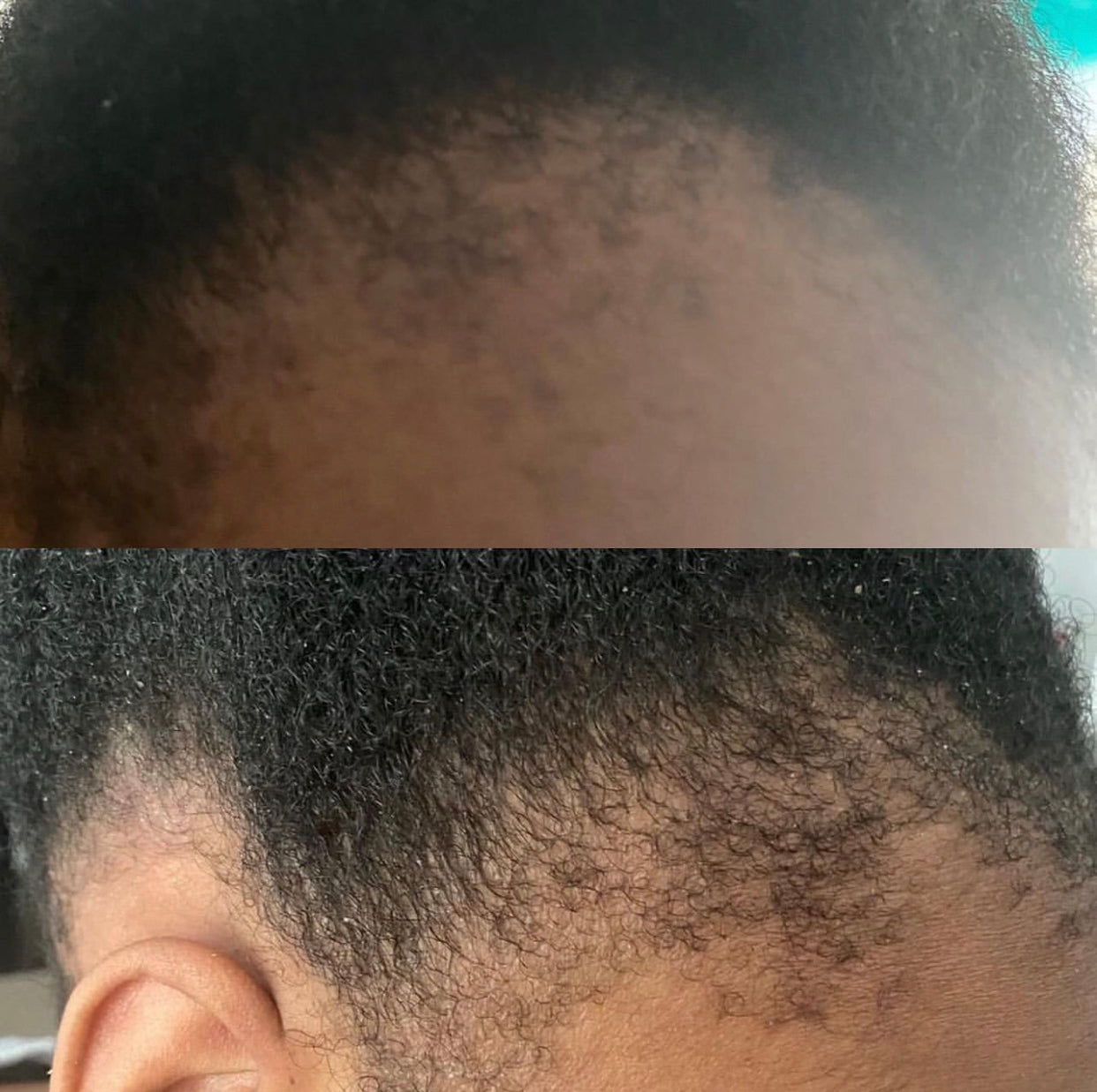 RETAIN hair/beard growth oil