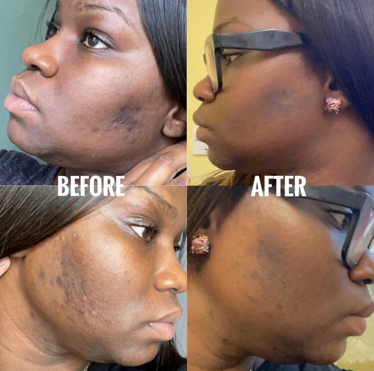 FADE lotion