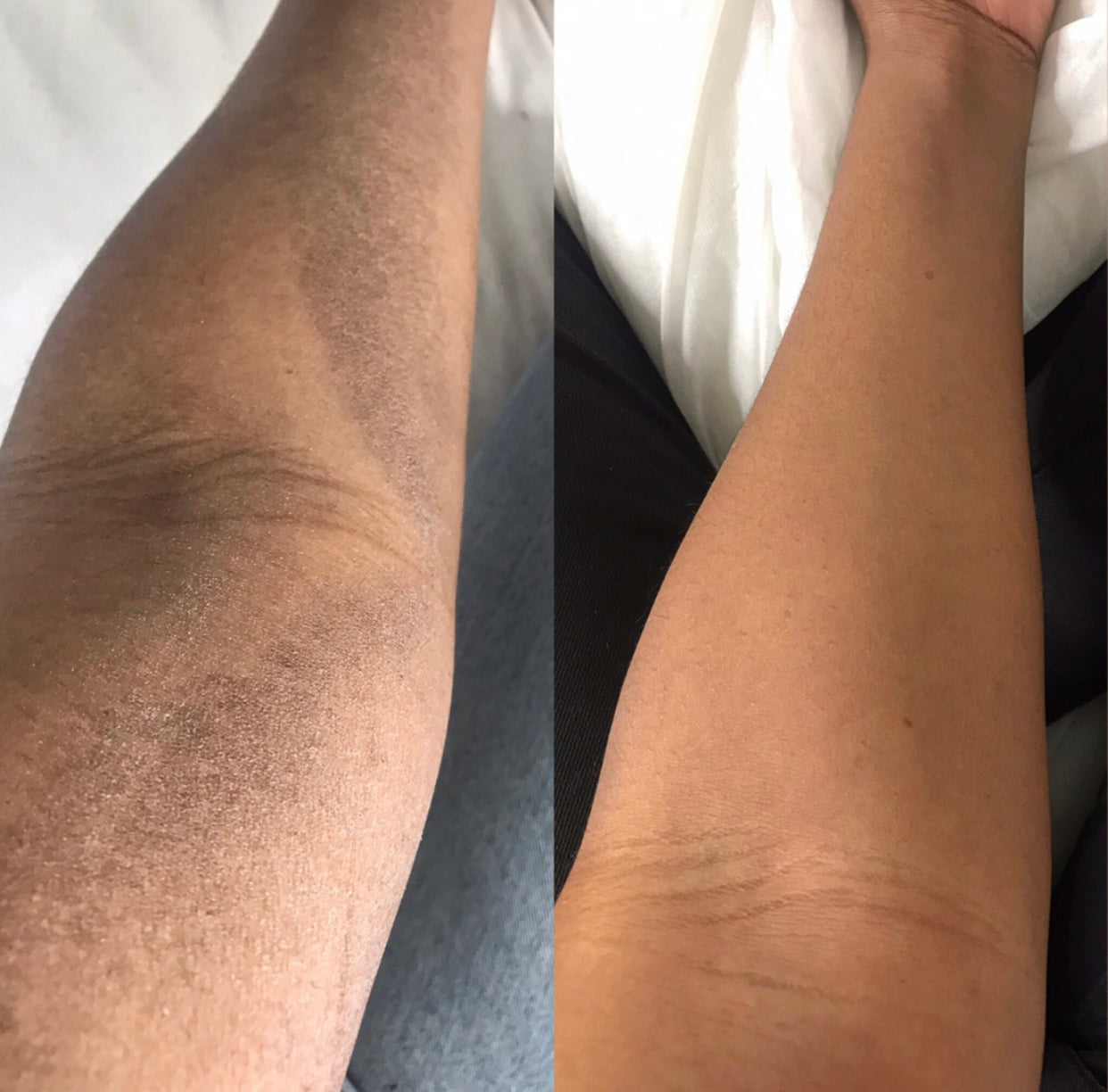 REPAIR skin butter