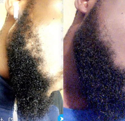 RETAIN hair/beard growth oil