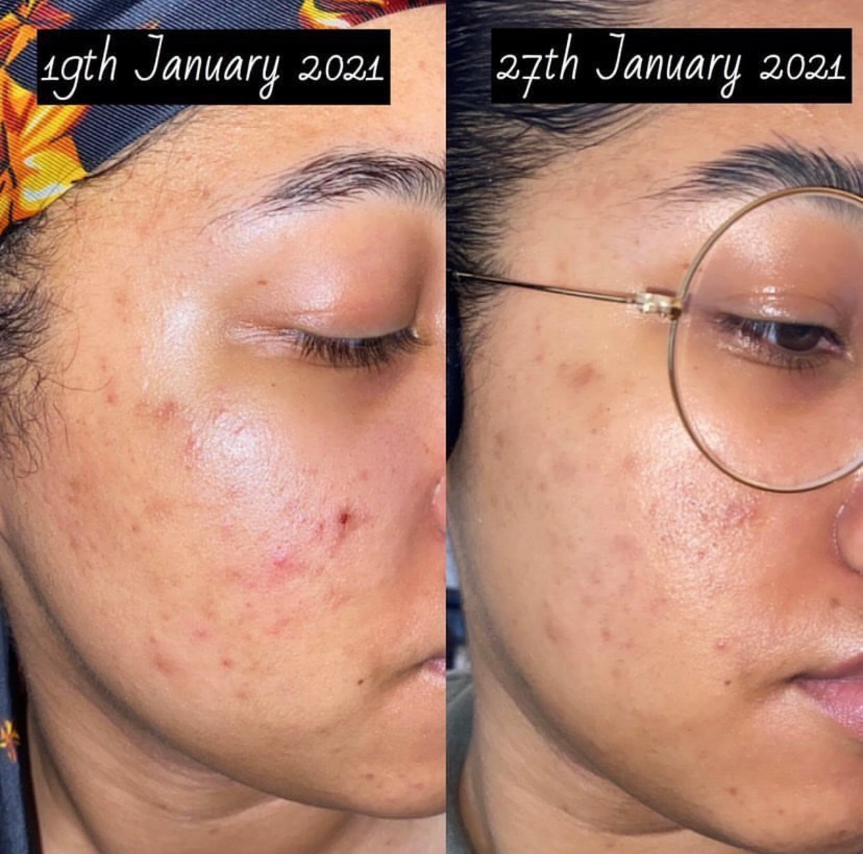 BLOOM skin oil