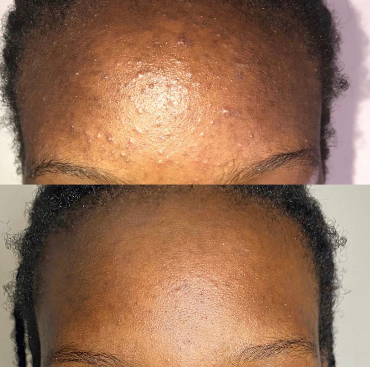 RADIANT toner